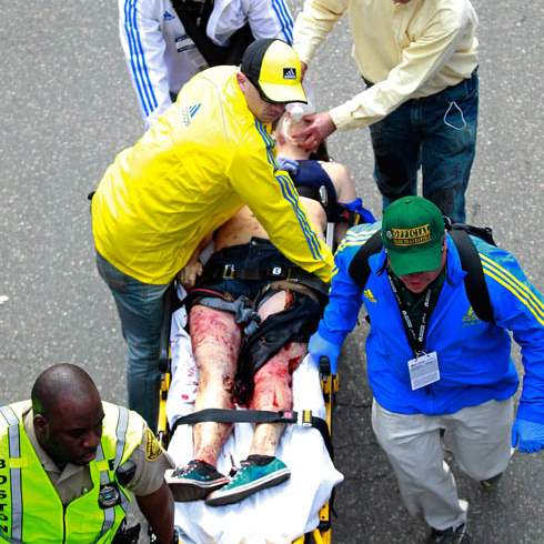 APTOPIX-Boston-Marathon-Explosion-injury