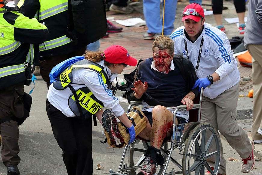 APTOPIX-Boston-Marathon-Explosions-injured-man